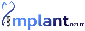 implant-logo.png.webp