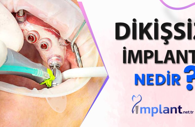 İmplant Tedavisi