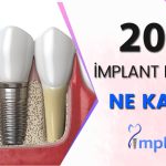 İmplant Fiyatları