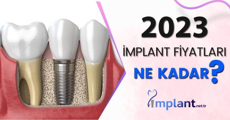 İmplant Fiyatları