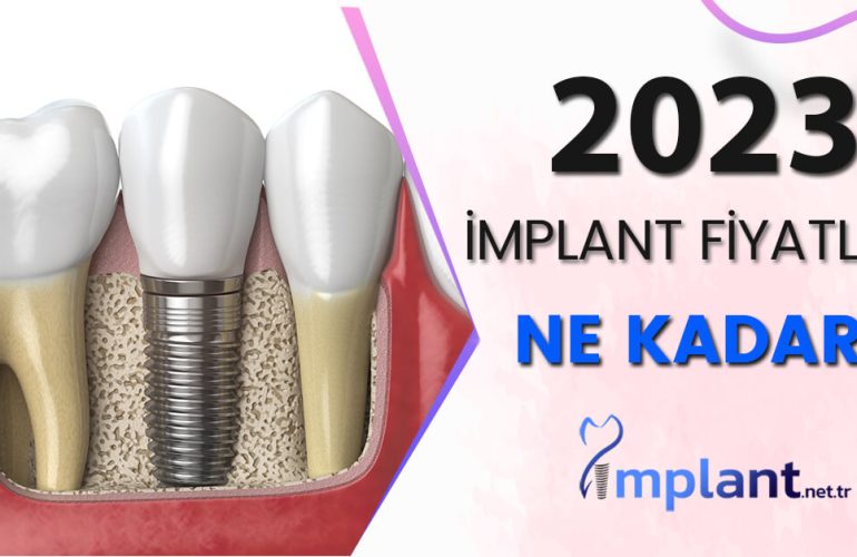 İmplant Tedavisi