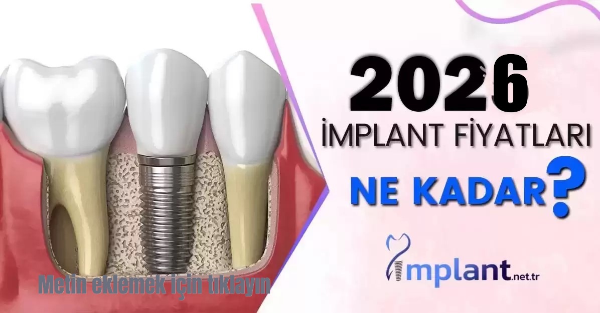 İmplant Tedavisi İmplant Tedavisi