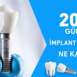 2026 implant fiyatları