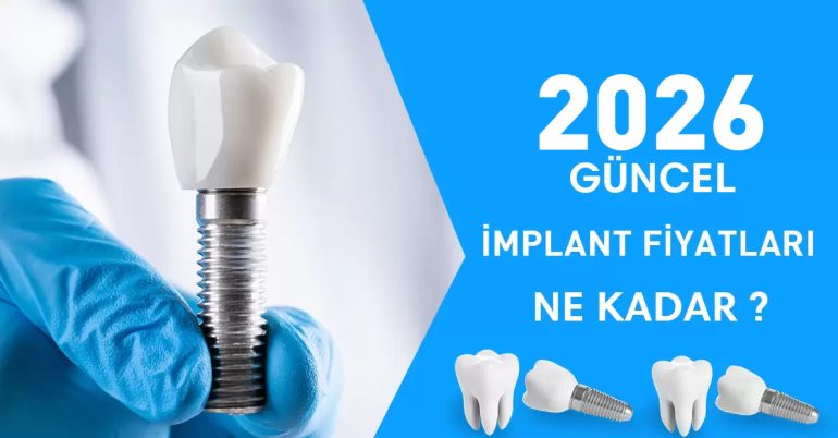İmplant Tedavisi 2026 implant fiyatları