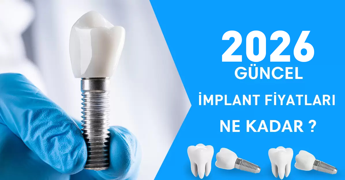 İmplant Tedavisi 2026 implant fiyatları